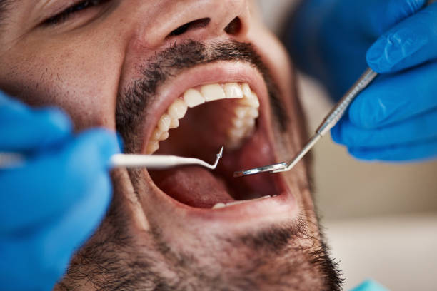 Best Lost Filling or Crown Replacement in Roodhouse, IL