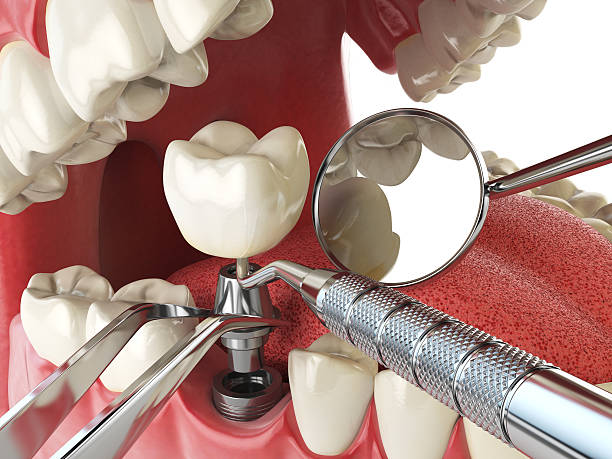 Best Emergency Care for Gum Disease in Roodhouse, IL